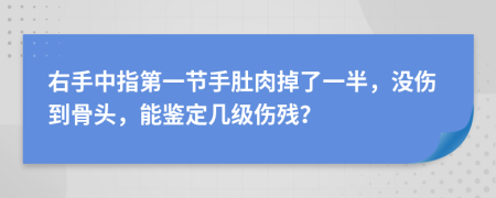 右手中指第一节手肚肉掉了一半，没伤到骨头，能鉴定几级伤残？