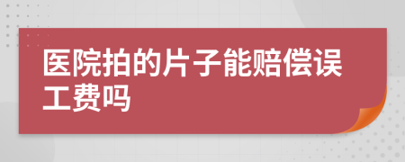 医院拍的片子能赔偿误工费吗