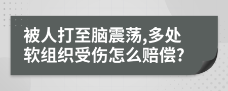 被人打至脑震荡,多处软组织受伤怎么赔偿?