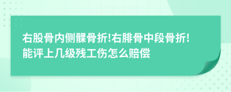 右股骨内侧髁骨折!右腓骨中段骨折!能评上几级残工伤怎么赔偿