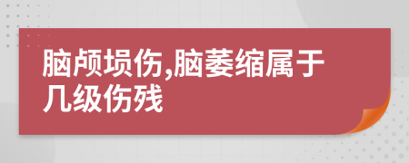 脑颅埙伤,脑萎缩属于几级伤残