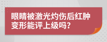 眼睛被激光灼伤后红肿变形能评上级吗？