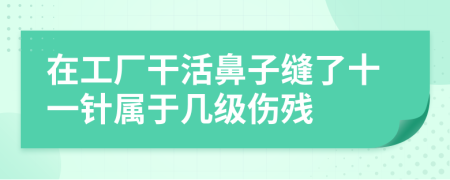 在工厂干活鼻子缝了十一针属于几级伤残