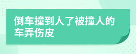 倒车撞到人了被撞人的车弄伤皮