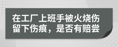 在工厂上班手被火烧伤留下伤痕，是否有赔尝