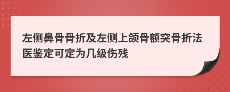 左侧鼻骨骨折及左侧上颌骨额突骨折法医鉴定可定为几级伤残