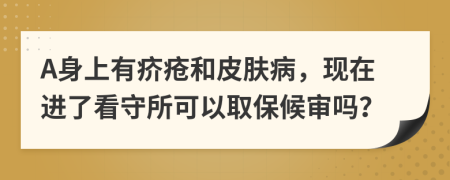 A身上有疥疮和皮肤病，现在进了看守所可以取保候审吗？