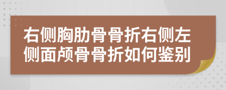 右侧胸肋骨骨折右侧左侧面颅骨骨折如何鉴别