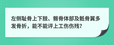 左侧耻骨上下肢、髂骨体部及骶骨翼多发骨折，能不能评上工伤伤残？