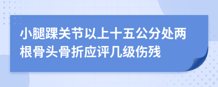 小腿踝关节以上十五公分处两根骨头骨折应评几级伤残