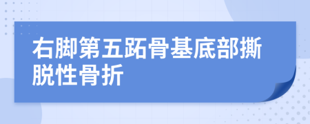 右脚第五跖骨基底部撕脱性骨折