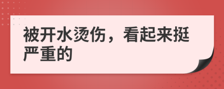 被开水烫伤，看起来挺严重的