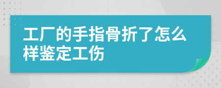 工厂的手指骨折了怎么样鉴定工伤