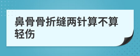 鼻骨骨折缝两针算不算轻伤