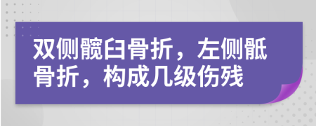 双侧髋臼骨折，左侧骶骨折，构成几级伤残