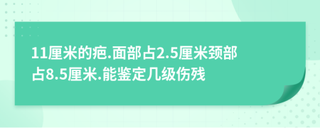 11厘米的疤.面部占2.5厘米颈部占8.5厘米.能鉴定几级伤残