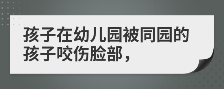 孩子在幼儿园被同园的孩子咬伤脸部，