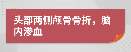 头部两侧颅骨骨折，脑内渗血
