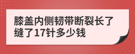 膝盖内侧韧带断裂长了缝了17针多少钱