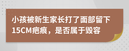 小孩被新生家长打了面部留下15CM疤痕，是否属于毁容