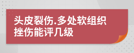 头皮裂伤.多处软组织挫伤能评几级