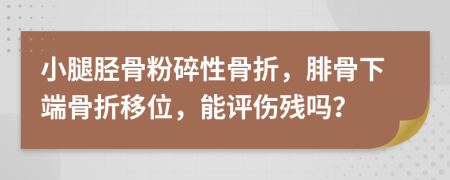 小腿胫骨粉碎性骨折，腓骨下端骨折移位，能评伤残吗？