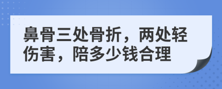 鼻骨三处骨折，两处轻伤害，陪多少钱合理