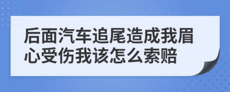 后面汽车追尾造成我眉心受伤我该怎么索赔