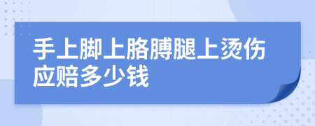 手上脚上胳膊腿上烫伤应赔多少钱