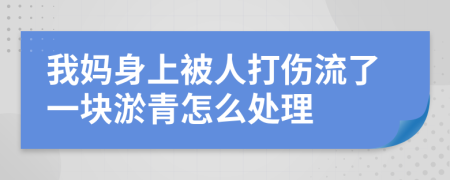 我妈身上被人打伤流了一块淤青怎么处理