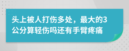 头上被人打伤多处，最大的3公分算轻伤吗还有手臂疼痛