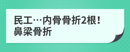 民工…内骨骨折2根！鼻梁骨折