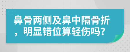 鼻骨两侧及鼻中隔骨折，明显错位算轻伤吗？