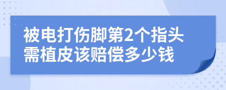 被电打伤脚第2个指头需植皮该赔偿多少钱