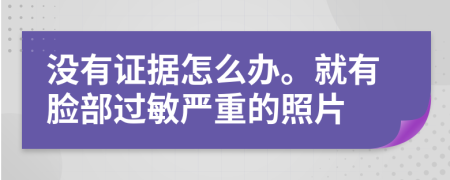 没有证据怎么办。就有脸部过敏严重的照片