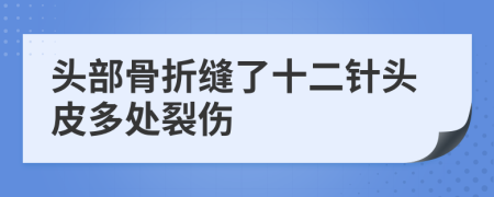 头部骨折缝了十二针头皮多处裂伤