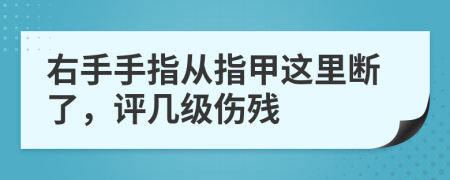 右手手指从指甲这里断了，评几级伤残