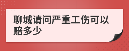 聊城请问严重工伤可以赔多少