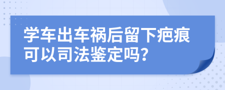 学车出车祸后留下疤痕可以司法鉴定吗？