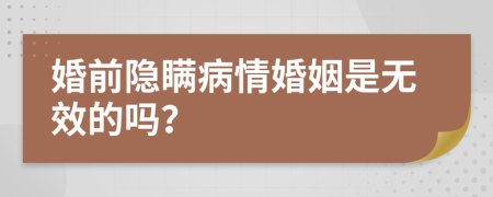 婚前隐瞒病情婚姻是无效的吗？