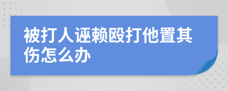 被打人诬赖殴打他置其伤怎么办