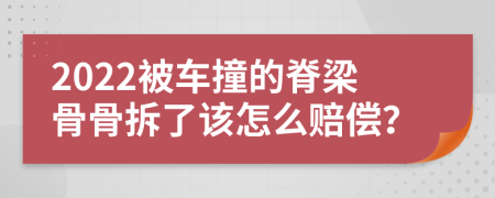 2022被车撞的脊梁骨骨拆了该怎么赔偿？