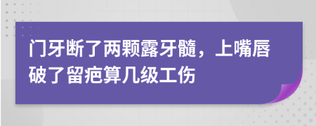 门牙断了两颗露牙髓，上嘴唇破了留疤算几级工伤