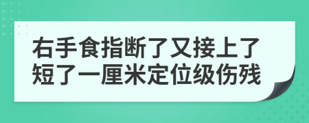 右手食指断了又接上了短了一厘米定位级伤残