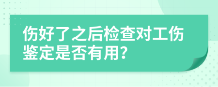 伤好了之后检查对工伤鉴定是否有用？