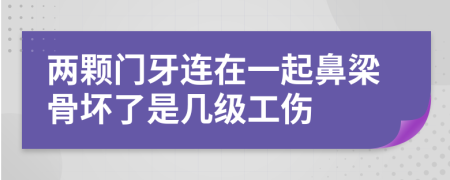 两颗门牙连在一起鼻梁骨坏了是几级工伤