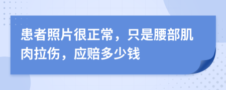 患者照片很正常，只是腰部肌肉拉伤，应赔多少钱