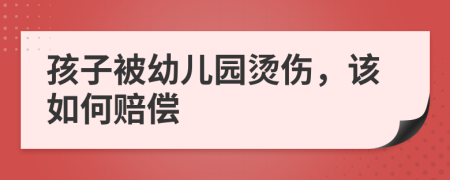 孩子被幼儿园烫伤，该如何赔偿
