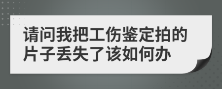 请问我把工伤鉴定拍的片子丢失了该如何办