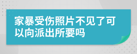 家暴受伤照片不见了可以向派出所要吗
